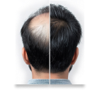 cấy ghép thẩm mỹ