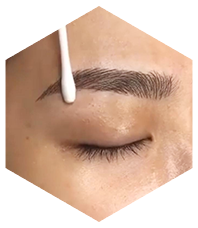 khử trùng vị trí lông mày cấy khu trung vi tri long may cay