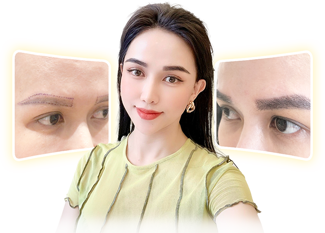 Phương pháp cấy lông mày