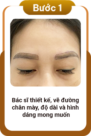 Quy trình cấy lông mày