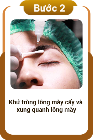 Quy trình cấy lông mày