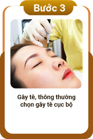Quy trình cấy lông mày