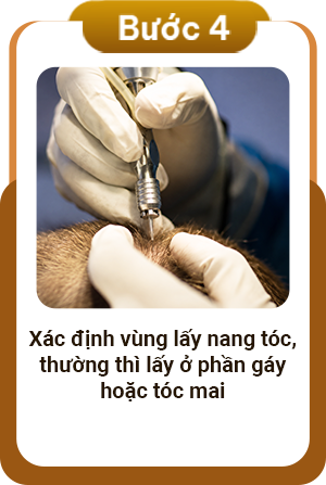 Quy trình cấy lông mày