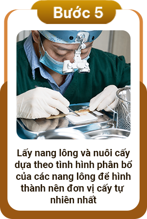 Quy trình cấy lông mày