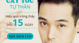 cấy tóc có hiệu quả không