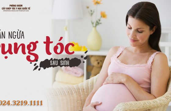 Bị rụng tóc trong thời kỳ cho con bú có cấy tóc được không?