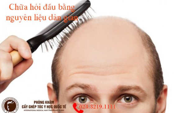chữa hói đầu bằng nguyên liệu dân gian