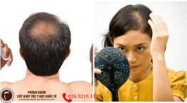 thận yếu gây rụng tóc