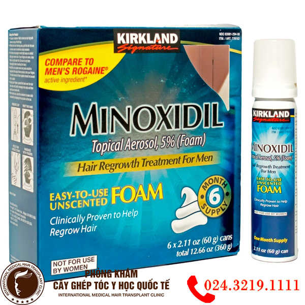 Thuốc minoxidil trị rụng tóc