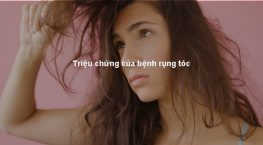 triệu chứng tóc rụng nhiều ở nữ