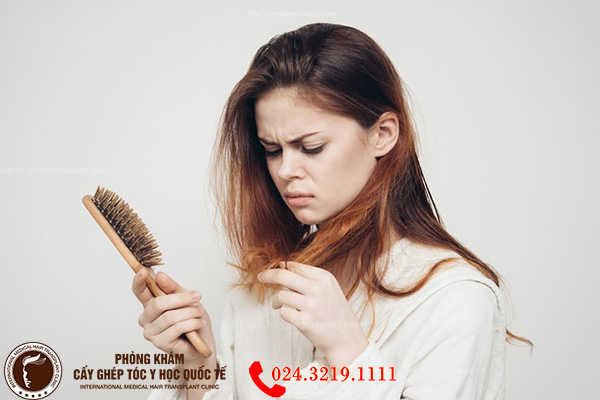 triệu chứng tóc rụng nhiều ở nữ