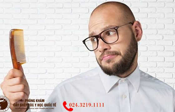 hói đầu di truyền