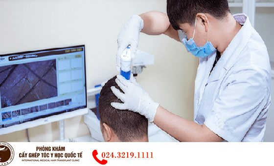 Thiết bị kiểm tra nang tóc