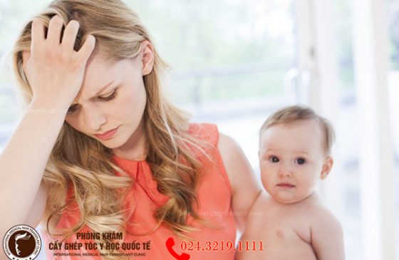 4 Mẹo ngăn ngừa rụng tóc sau sinh trước 3 tháng cho bà bầu