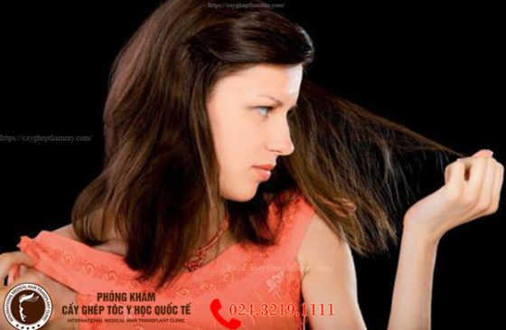 nguyên nhân rụng tóc tuổi 18