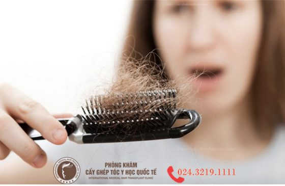 rụng tóc chân tóc có hạt trắng
