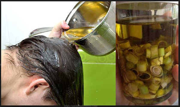 5 cách trị rụng tóc bằng sả hiệu quả và an toàn