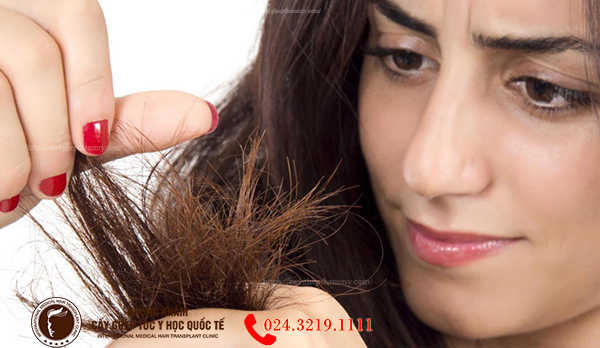 Cách chữa đuôi tóc khô xơ chẻ ngọn  Nhà thuốc FPT Long Châu