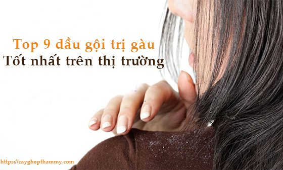 review dầu gội trị gàu