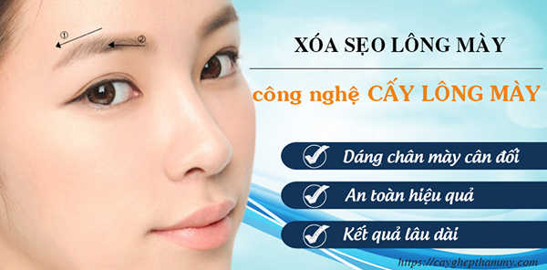 xóa sẹo chân mày bằng xăm lông mày
