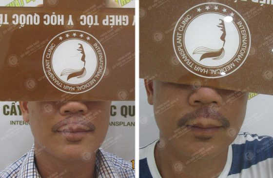 Trương Đức Quang