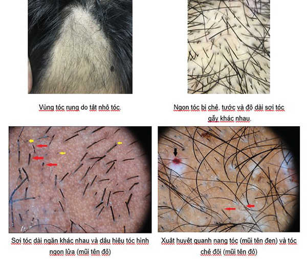 Top hơn 99 hình về giật tóc nam có hại không - thuvientinhoc.edu.vn