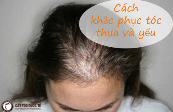 cách khắc phục tóc thưa và yếu