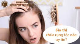 địa chỉ chữa rụng tóc nào uy tín