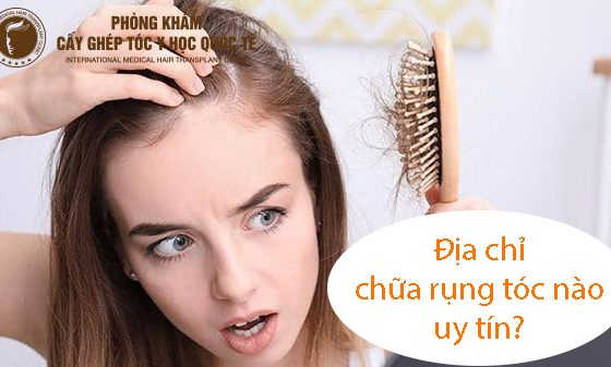 địa chỉ chữa rụng tóc nào uy tín