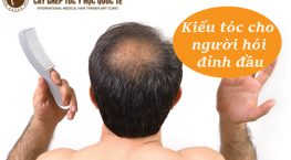 Kiểu tóc cho người hói đỉnh đầu