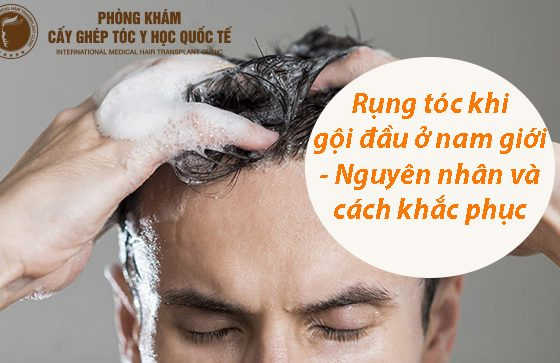 rụng tóc khi gội đầu ở nam giới