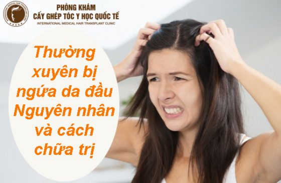 thường xuyên bị ngứa da đầu