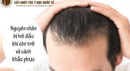bị hói đầu khi còn trẻ