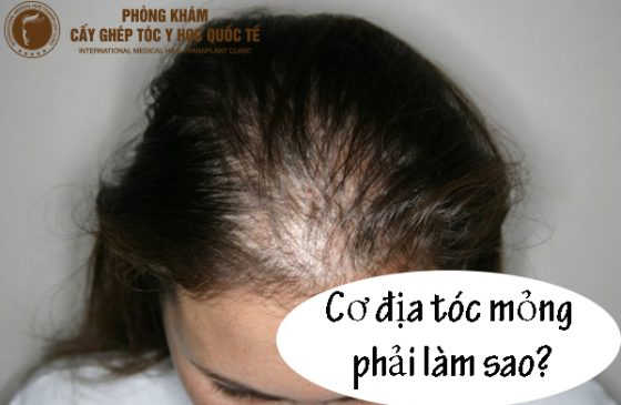 cơ địa tóc mỏng phải làm sao