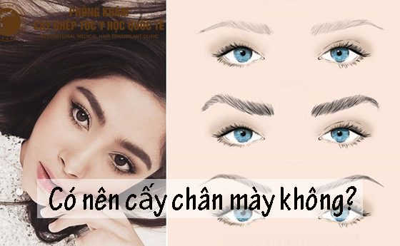 có nên cấy chân mày không