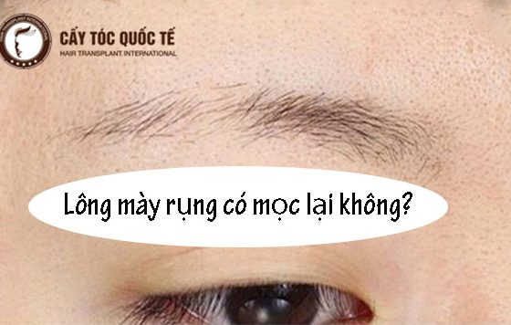 lông mày rụng có mọc lại không