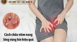 nang lông vùng kín nổi mụn