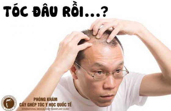 nguyên nhân tóc không mọc