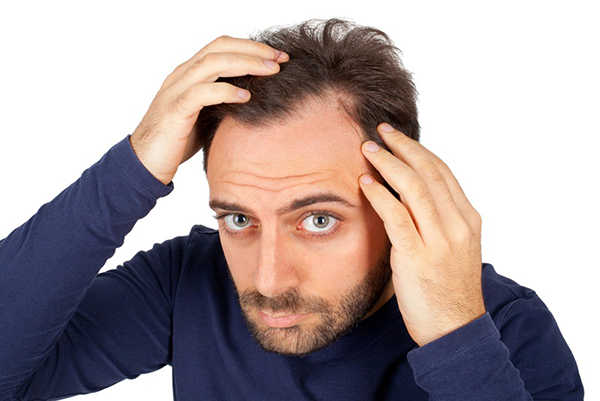Cách chăm sóc tóc mỏng nam giới không nên bỏ qua