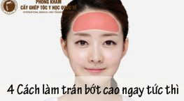 cách làm trán bớt cao