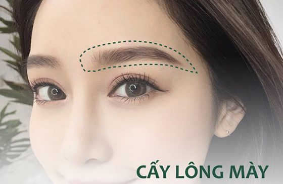 cấy lông mày có hiệu quả không