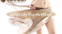 có nên cấy lông mu không