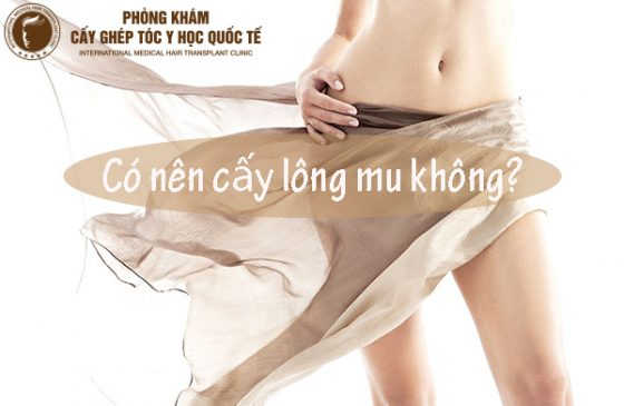 có nên cấy lông mu không