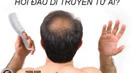 Hói đầu di truyền từ ai