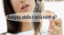 rụng tóc nhiều ở nữ là bệnh gì