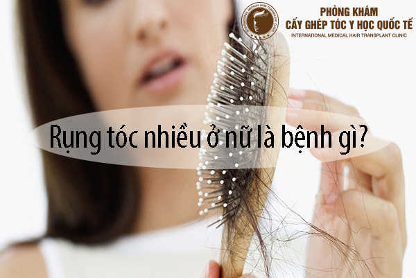 Cách chữa rụng tóc nhiều ở nữ giới cần biết.