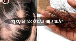 Trị rụng tóc ở đâu hiệu quả