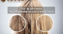Tóc bị gãy khúc