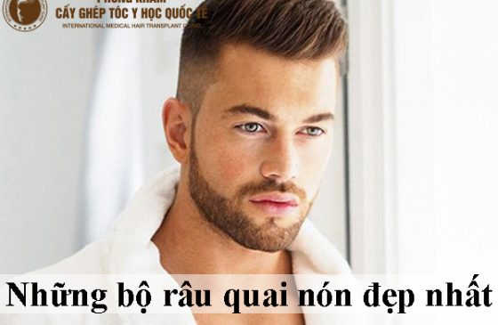 Những bộ râu quai nón đẹp nhất
