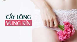 cấy lông mu ở Hà Nội